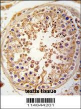 Anti-JLP (SPAG9) (N-term) Antibody