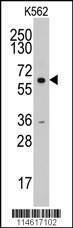 Anti-Cyclin A (CCNA2) (N-term) Antibody