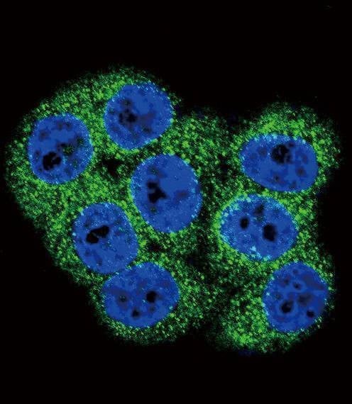 Anti-DDR1 (Center) Antibody