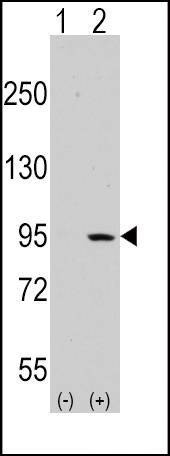 Anti-DDR1 (Center) Antibody