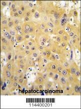 Anti-ECGF1 (Center) Antibody