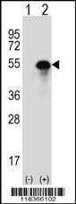 Anti-CA14 (N-term) Antibody