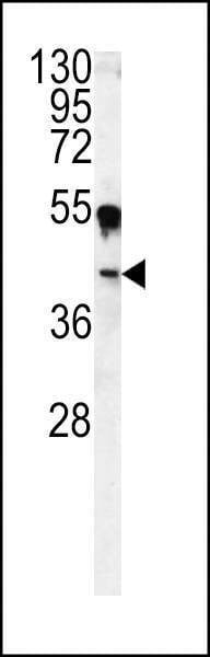 Anti-CA14 (N-term) Antibody