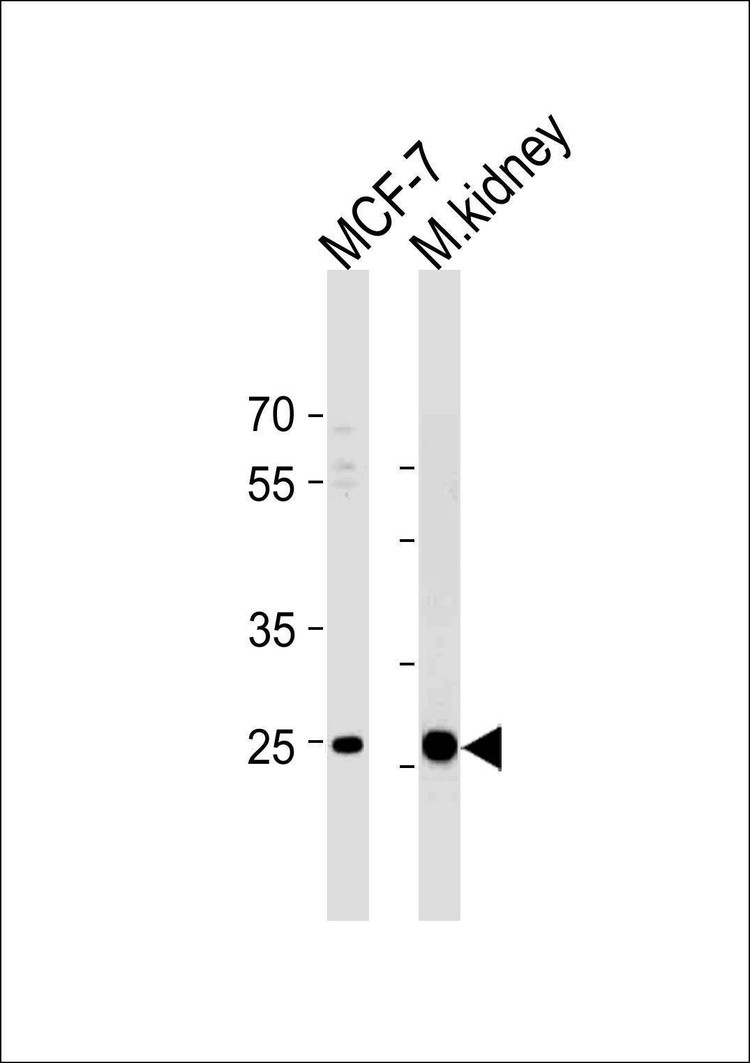 Anti-CA2 (N-term) Antibody