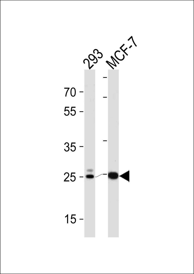 Anti-CA2 (C-term) Antibody
