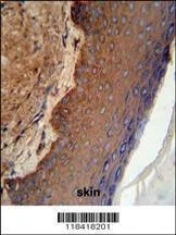 Anti-KRT9 (Center K317) Antibody