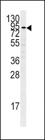 Anti-PLG (C-term) Antibody