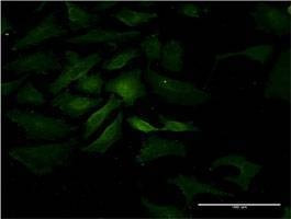 Anti-IL15 Antibody