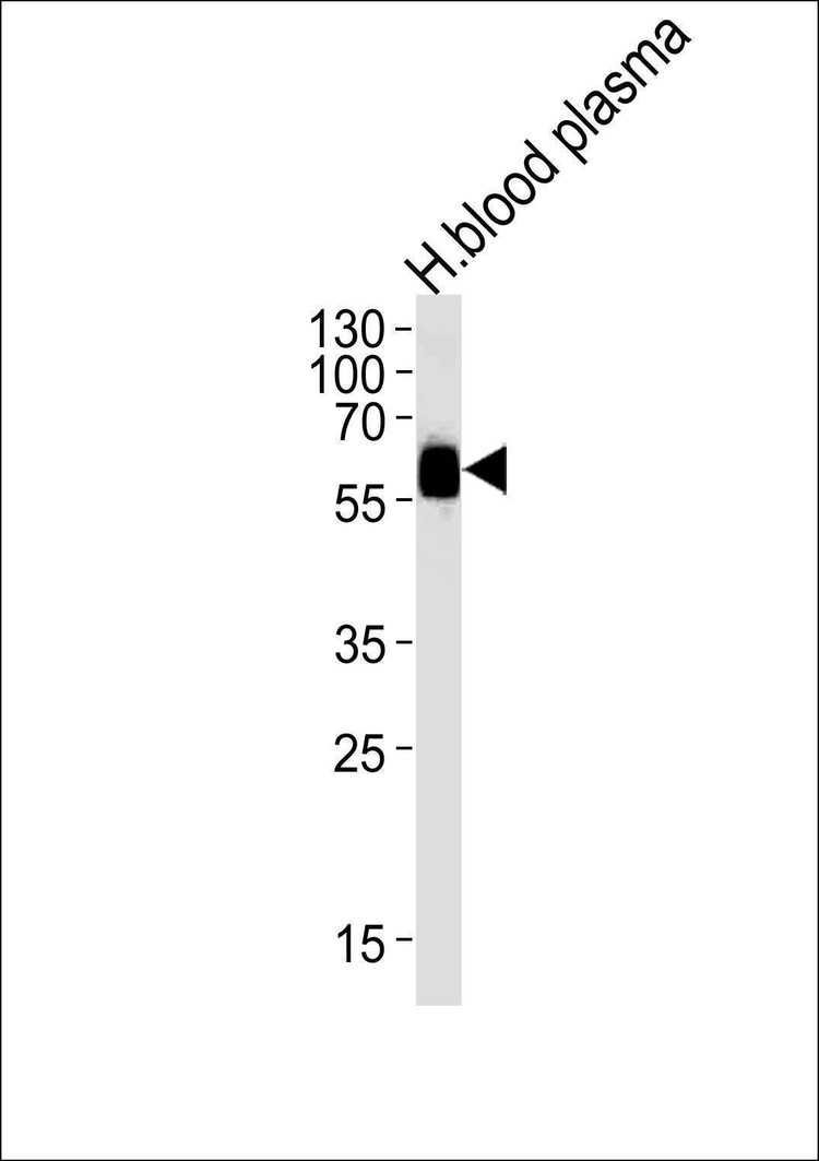 Anti-SERPINA3 (C-term) Antibody