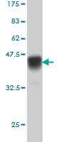 Anti-IL15RA Antibody