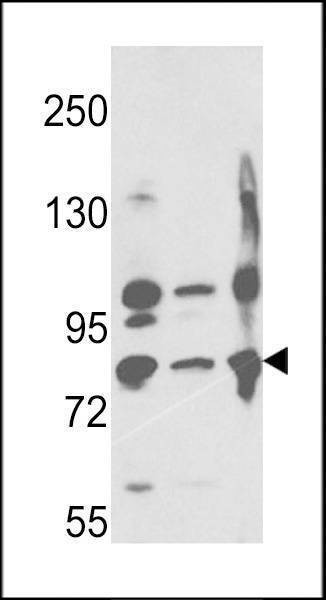 Anti-Neprilysin (C-term) Antibody