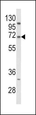 Anti-PCSK9 (N-term) Antibody