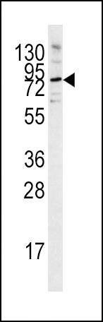 Anti-PCSK9 (C-term) Antibody