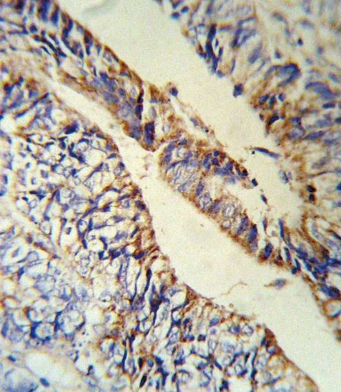 Anti-PCSK9 (C-term) Antibody