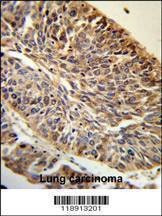 Anti-PITX1 (Center) Antibody