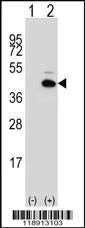 Anti-PITX1 (Center) Antibody