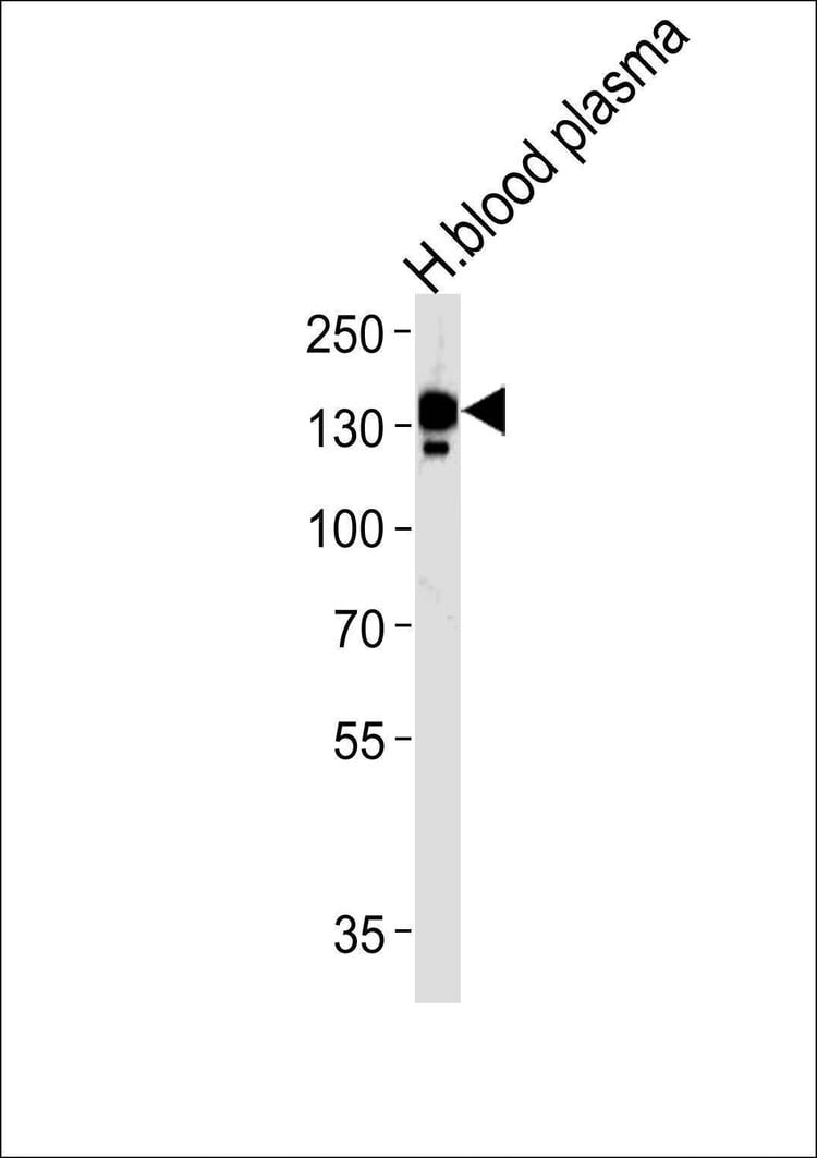 Anti-CP (N-term) Antibody