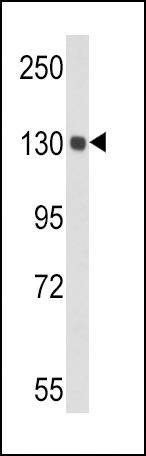 Anti-CP (Center) Antibody