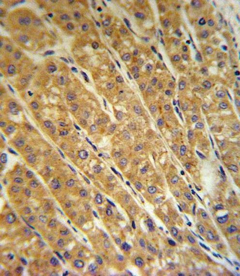 Anti-CP (Center) Antibody