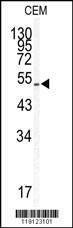 Anti-KLF5 (Center) Antibody