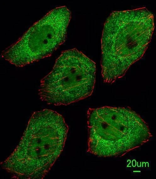 Anti-PTTG1 (N-term) Antibody