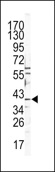 Anti-CATB (Center) Antibody