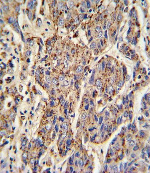 Anti-CATB (Center) Antibody