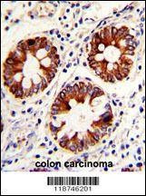 Anti-CYK18 (C-term) Antibody