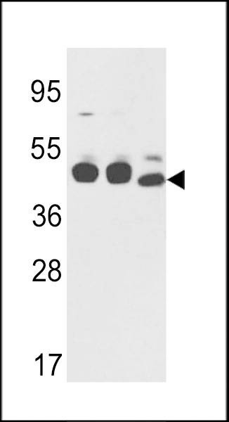 Anti-CYK18 (C-term) Antibody