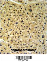 Anti-FKBP9 (N-term) Antibody