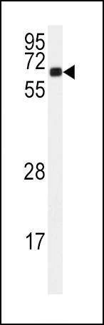 Anti-CAMK2A (C-term E370) Antibody