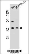Anti-ANXA2 (N-term) Antibody