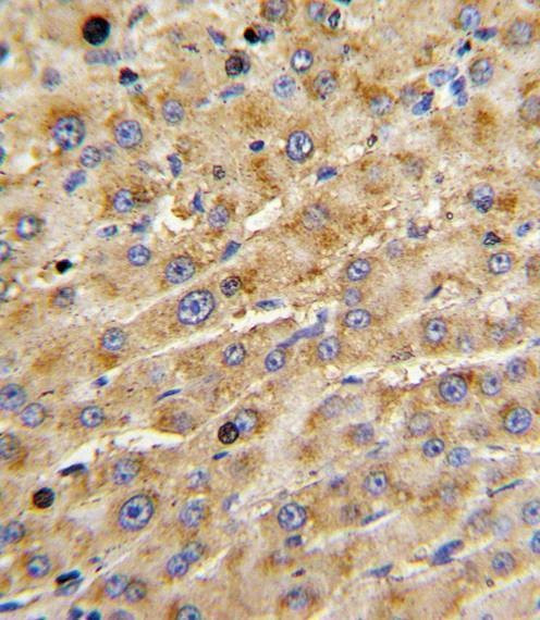 Anti-ADAMTS13 (Center) Antibody