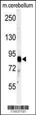 Anti-ADAMTS4 (C-term) Antibody