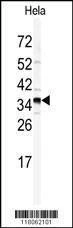 Anti-GOLPH3 (N-term) Antibody
