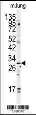 Anti-GOLPH3 (C-term) Antibody
