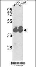 Anti-IDH1 (Center) Antibody