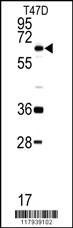 Anti-DDX5 (C-term) Antibody
