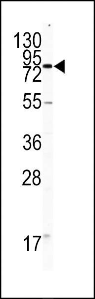 Anti-CD31 (C-term) Antibody