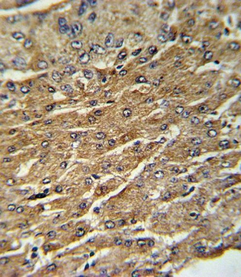 Anti-GPT (N-term P101) Antibody