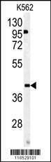 Anti-OMD (Center) Antibody