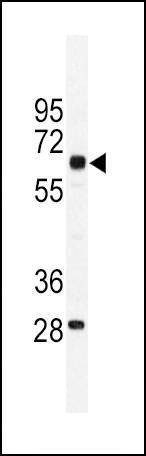 Anti-PKM1 (C-term L398) Antibody