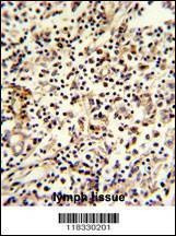 Anti-PCM-1 (C-term) Antibody