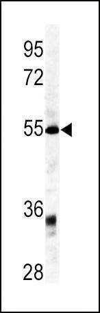 Anti-GDF6 (C-term) Antibody