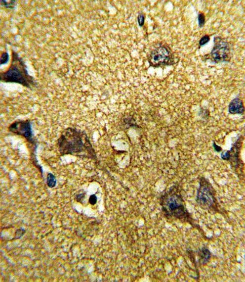 Anti-GDF6 (C-term) Antibody