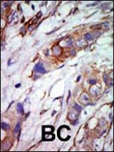 Anti-MAPK7 (C-term) Antibody
