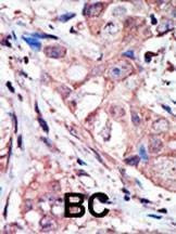 Anti-MAPK10 (N-term) Antibody