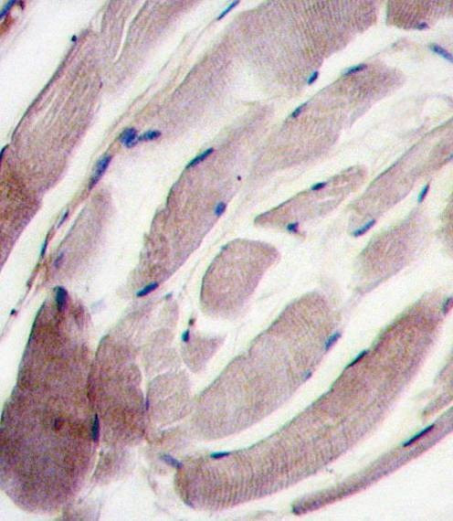 Anti-MAPK12 (C-term) Antibody