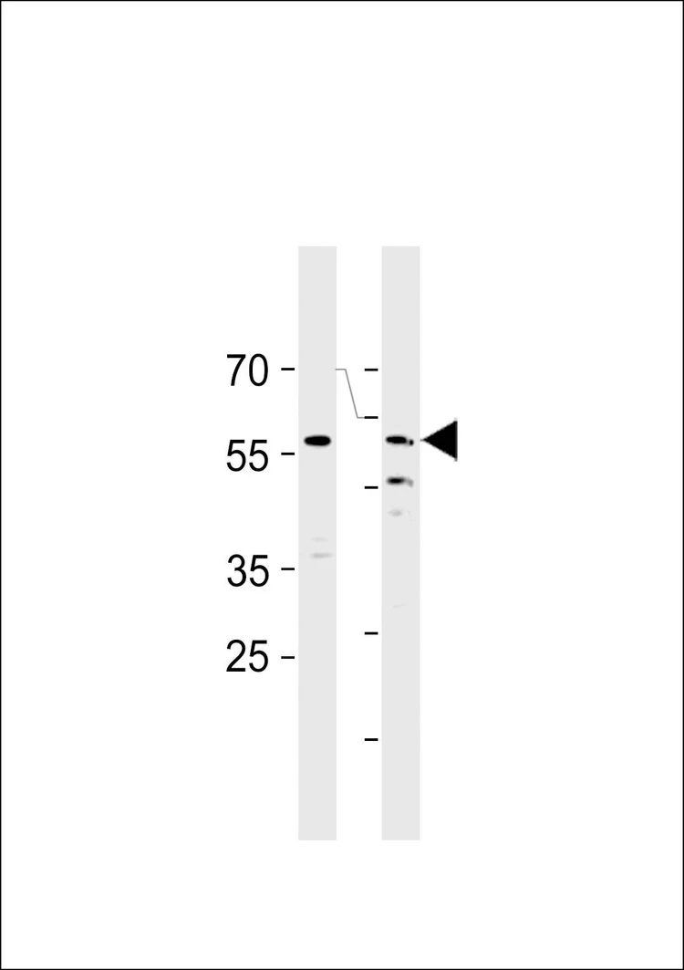 Anti-CDC7 (CDC7L1) (N-term) Antibody