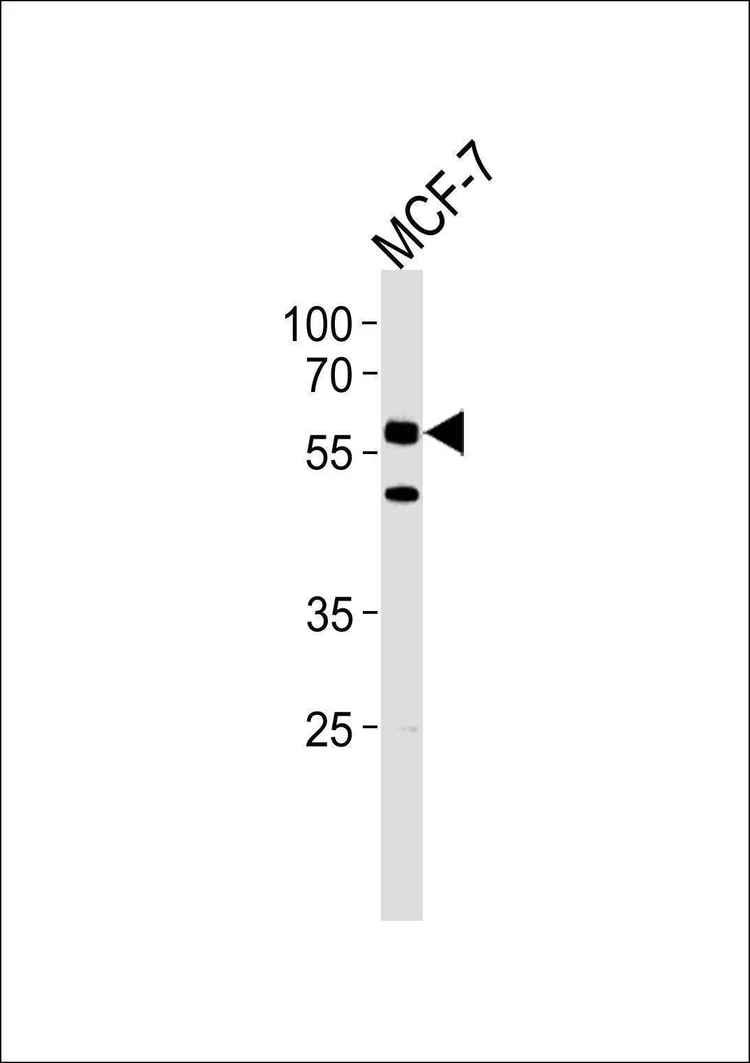 Anti-CDC7 (CDC7L1) (N-term) Antibody